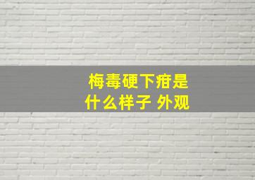 梅毒硬下疳是什么样子 外观